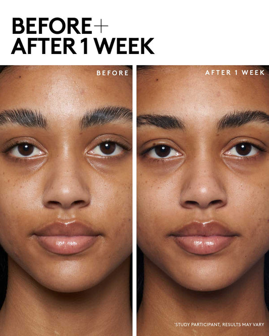 model image of model using blah to bright before and after 1 week