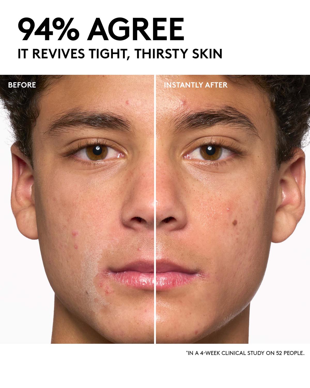 Before and after comparison of a person's face with text indicating skin revival.